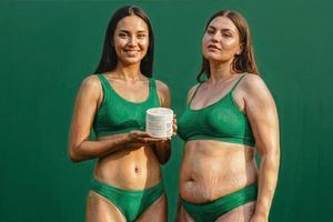 Целюліт: причини появи, профілактика та ефективні способи зменшення фото